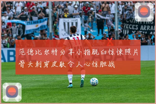 范德比尔特分享小指脱臼惊悚照片骨头刺穿皮肤令人心惊胆战